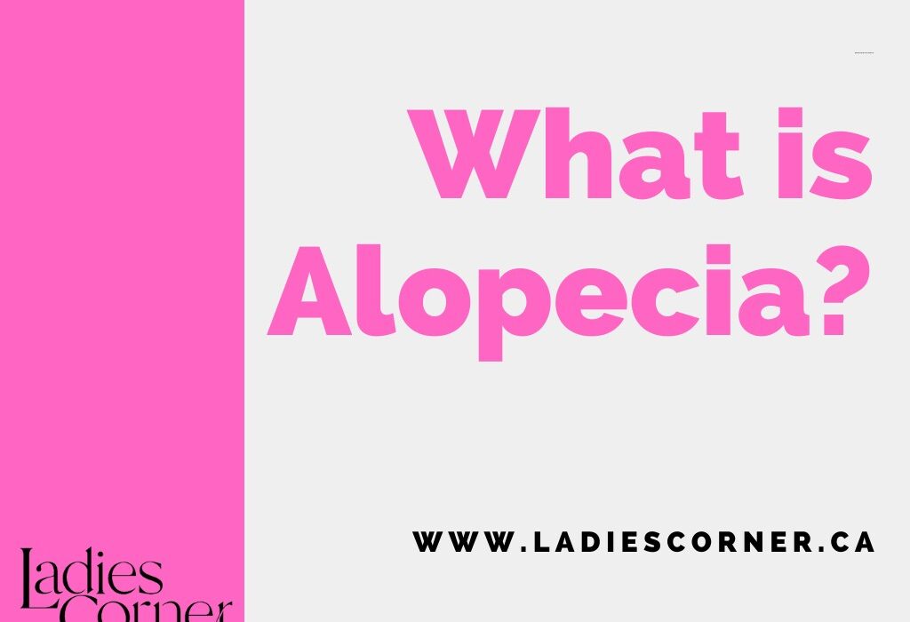 What is Alopecia?