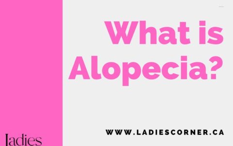 What is Alopecia?