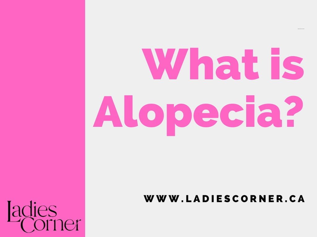 What is Alopecia?