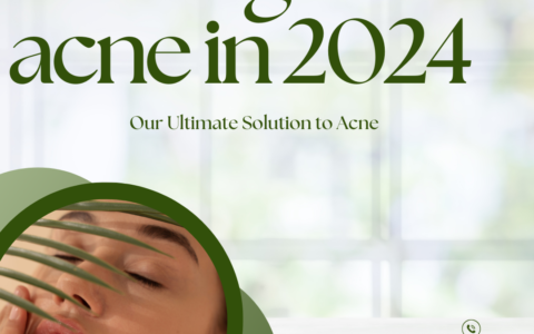 managing acne involves a combination of a consistent skincare routine, targeted treatments, lifestyle adjustments, and, when necessary, professional guidance. By understanding and addressing the various factors that contribute to acne, you can work towards clearer, healthier skin.