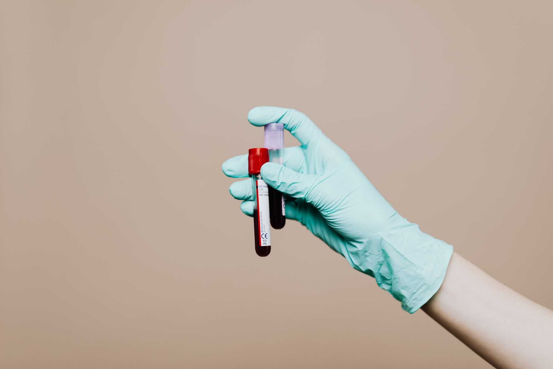 Canadian Researchers Trial Blood Test to Detect Early Cancer Recurrence