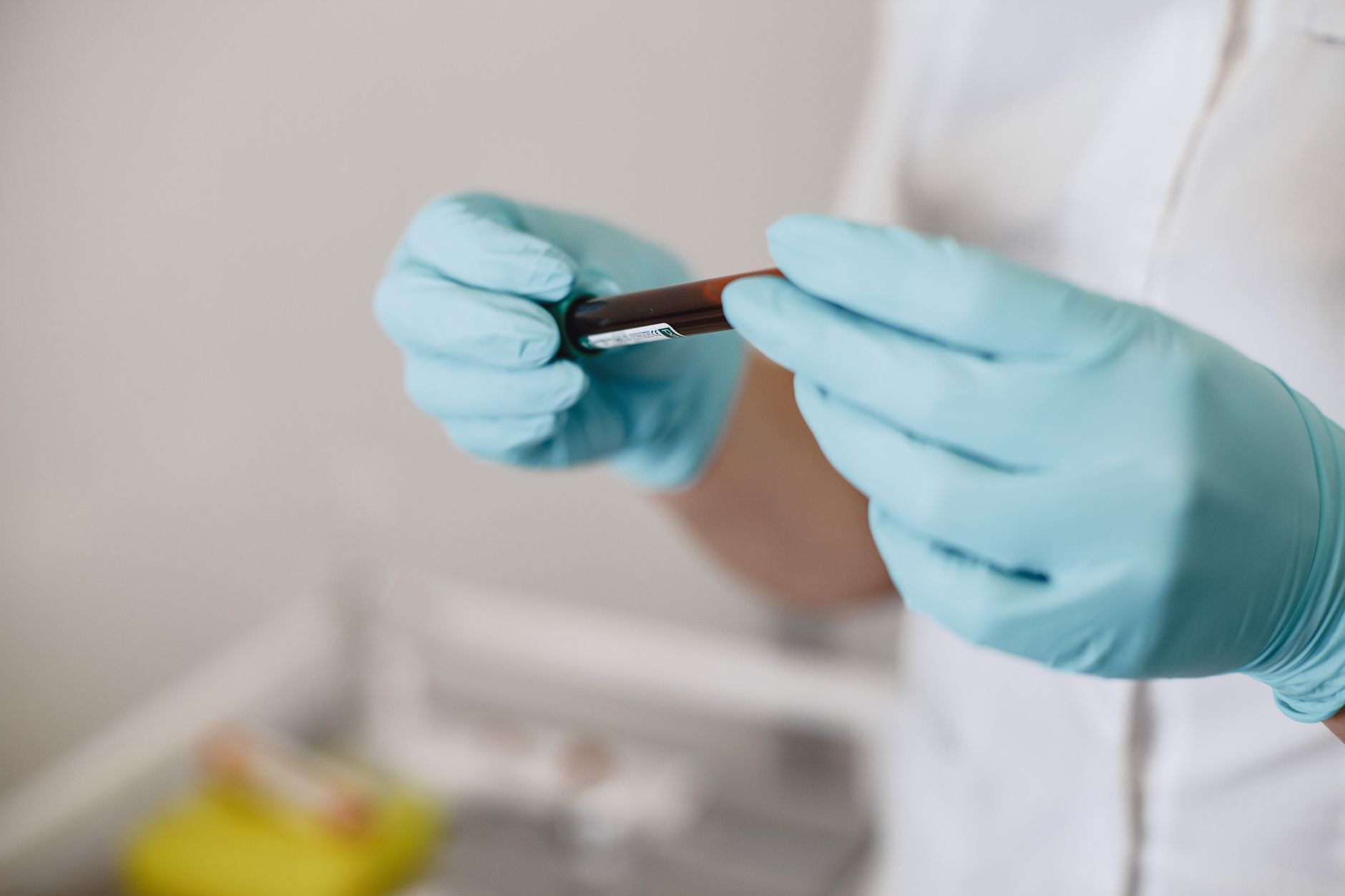 Can a Liquid Biopsy Detect Returning Cancer? New Trials Offer Hope for Early Detection